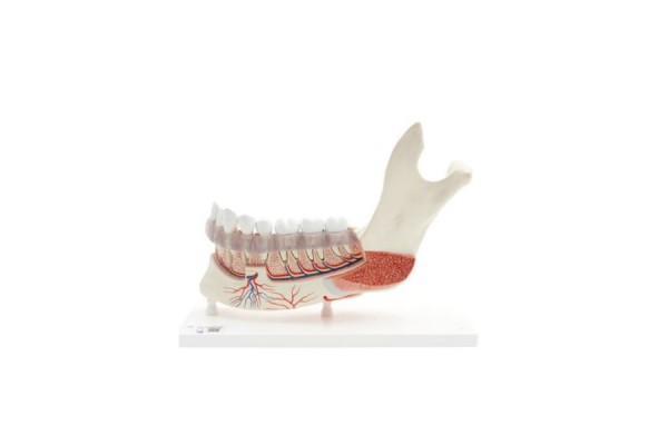 kompleksowy model żuchwy (lewa połowa) z chorymi zębami, nerwami, naczyniami i gruczołami, 19 części - 1001250 [ve290] 3b scientific modele anatomiczne 2
